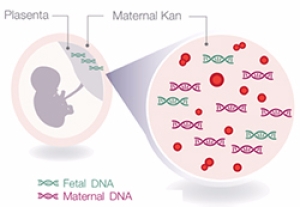 Panorama Test - Non İnvaziv Prenatal Test (NIPT)